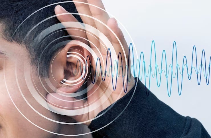 کمشنوایی ناگهانی حسی-عصبی